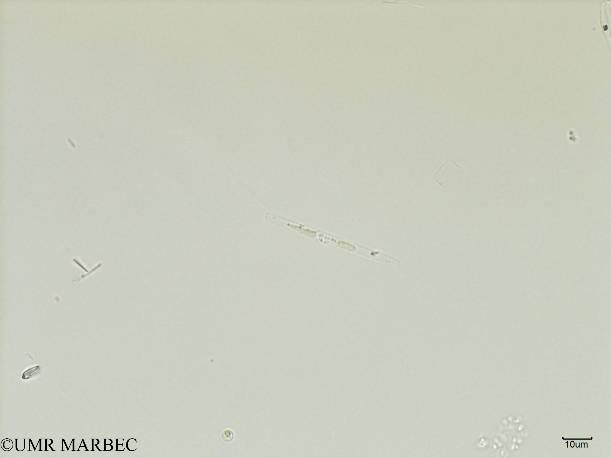 phyto/Scattered_Islands/iles_glorieuses/SIREME May 2016/Pennée spp 3-5x15-40µm (Pennée SIREME-Glorieuses2016-GLO2F-101116-pennée moy)(copy).jpg